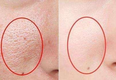 影院入口 每个人都需要短暂地海报